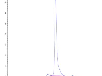 Human Notch 3 Protein (NOT-HM403)