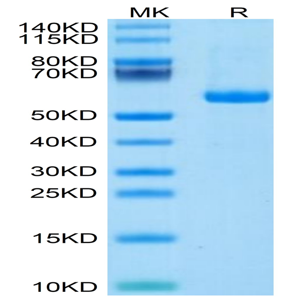 Human Notch 3 Protein (NOT-HM403)