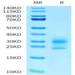 Human NPC2 Protein (NPC-HM102)
