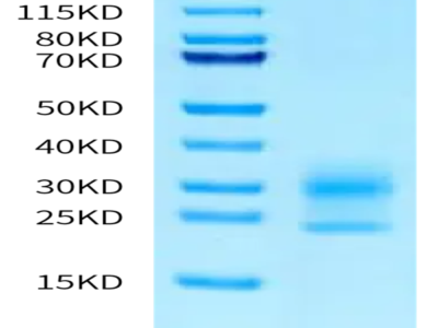 Human NPC2 Protein (NPC-HM102)