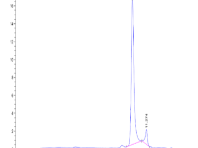 Human NRAS Protein (NRS-HE101)