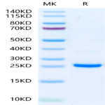 Human NRAS Protein (NRS-HE101)