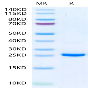 Human NRAS Protein (NRS-HE101)