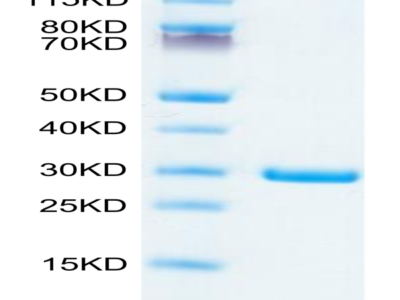 SARS-COV-2 NSP7&NSP8 Protein (NSP-VE178)