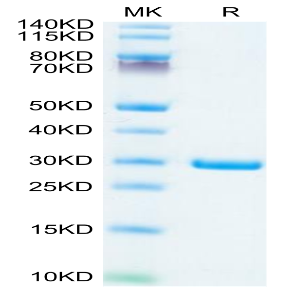 SARS-COV-2 NSP7&NSP8 Protein (NSP-VE178) SARS-COV-2 NSP7&NSP8 Protein (NSP-VE178)