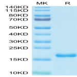 SARS-COV-2 Nucleocapsid Protein NTD Domain Protein (NTD-VE4NP)