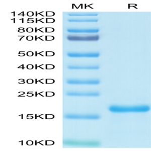 SARS-COV-2 Nucleocapsid Protein NTD Domain Protein (NTD-VE4NP)