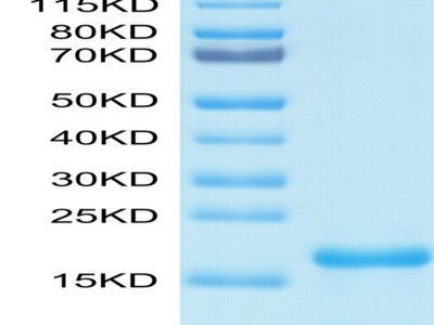 SARS-COV-2 Nucleocapsid Protein NTD Domain Protein (NTD-VE4NP)