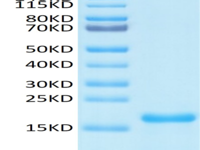 Biotinylated SARS-COV-2 Nucleocapsid Protein NTD Domain Protein (NTD-VE4NPB)