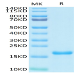 SARS-COV-2 Nucleocapsid Protein NTD Domain Protein (NTD-VE4NP)