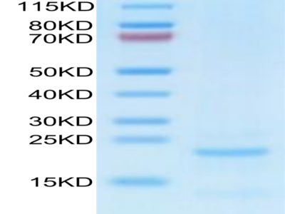 Cynomolgus NTS1 Protein (NTS-CM101)