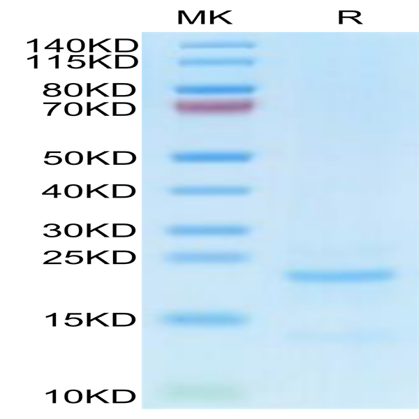 Cynomolgus NTS1 Protein (NTS-CM101) Cynomolgus NTS1 Protein (NTS-CM101)
