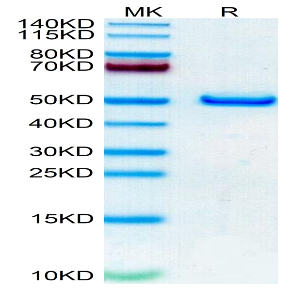 Human NTS1 Protein (NTS-HM201)