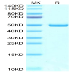 Mouse NTS1 Protein (NTS-MM201)