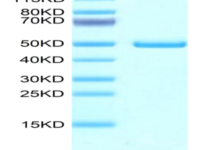 Mouse NTS1 Protein (NTS-MM201)