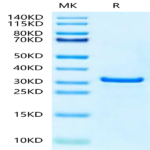 Human NUDT5 Protein (NUD-HE1T5)