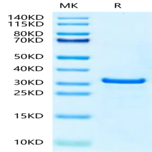 Human NUDT5 Protein (NUD-HE1T5)