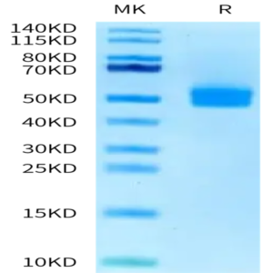 Human OGN/Osteoglycin Protein (OGN-HM101)