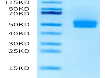 Human OGN/Osteoglycin Protein (OGN-HM101)