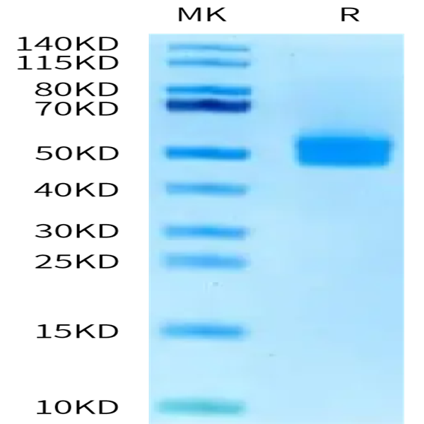 Human OGN/Osteoglycin Protein (OGN-HM101) Human OGN/Osteoglycin Protein (OGN-HM101)