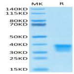 Human Oncostatin M/OSM Protein (ONM-HM401)