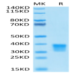 Biotinylated Human Oncostatin M/OSM Protein (ONM-HM401B)