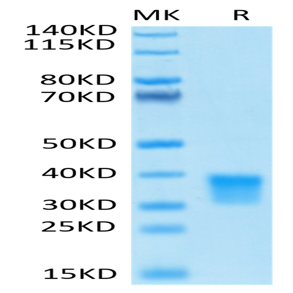 Biotinylated Human Oncostatin M/OSM Protein (ONM-HM401B)