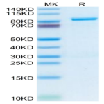 Human Periostin/OSF-2 Protein (OSF-HM102)
