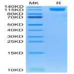 Cynomolgus OSMR Protein (OSM-CM101)