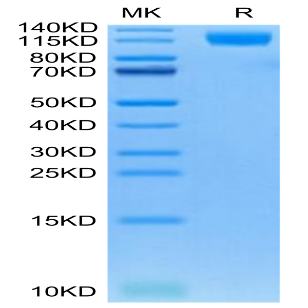 Cynomolgus OSMR Protein (OSM-CM101)