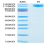 Human OSMR Protein (OSM-HM101)