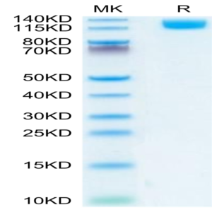 Mouse OSMR Protein (OSM-MM101)