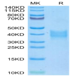 Mouse Oncostatin M/OSM Protein (OSM-MM102)