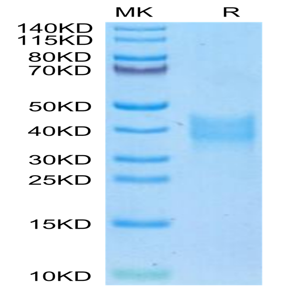 Mouse Oncostatin M/OSM Protein (OSM-MM102)