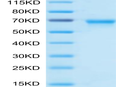 Biotinylated Human OX40/TNFRSF4/CD134 Protein (Primary Amine Labeling) (OX4-HM240B)