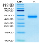 Cynomolgus IL-12B/p40/NKSF2 Protein (P40-CM112)