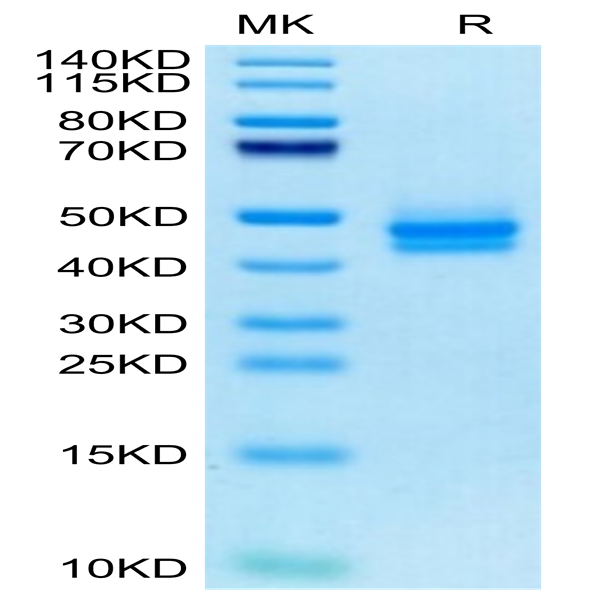Cynomolgus IL-12B/p40/NKSF2 Protein (P40-CM112)