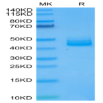 Human IL-12B/p40/NKSF2 Protein (P40-HM112)