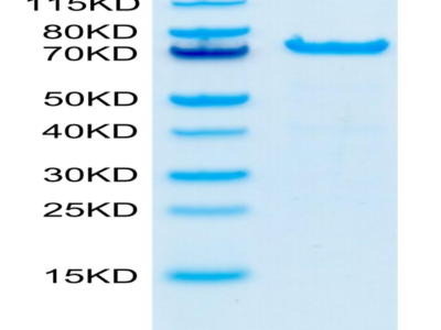 Cynomolgus PADI4 Protein (PAD-CE104)