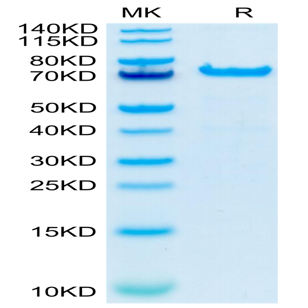 Cynomolgus PADI4 Protein (PAD-CE104) Cynomolgus PADI4 Protein (PAD-CE104)