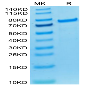 Biotinylated Cynomolgus PADI4 Protein (Primary Amine Labeling) (PAD-CE104B)