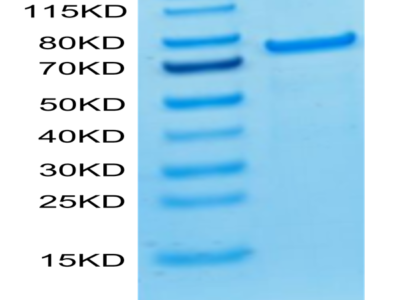 Biotinylated Cynomolgus PADI4 Protein (Primary Amine Labeling) (PAD-CE104B)