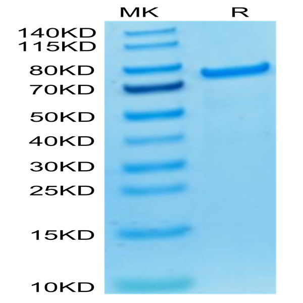Biotinylated Cynomolgus PADI4 Protein (Primary Amine Labeling) (PAD-CE104B)