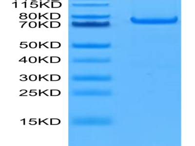 Human PADI4 Protein (PAD-HE104)