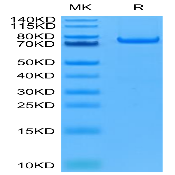 Human PADI4 Protein (PAD-HE104) Human PADI4 Protein (PAD-HE104)
