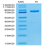 Biotinylated Human PADI4 Protein (Primary Amine Labeling) (PAD-HE104B)