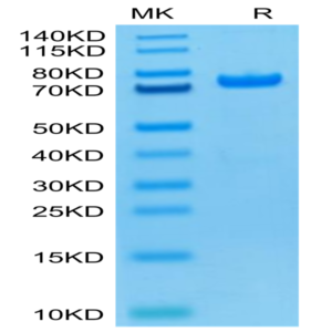 Biotinylated Human PADI4 Protein (Primary Amine Labeling) (PAD-HE104B)