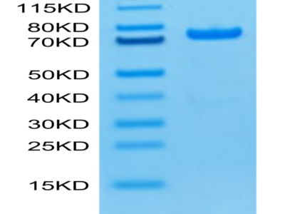 Biotinylated Human PADI4 Protein (Primary Amine Labeling) (PAD-HE104B)