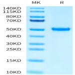 Human PAH (D415N) Protein (PAH-HB001)