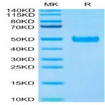 Human PAI-1 Protein (PAI-HM101)